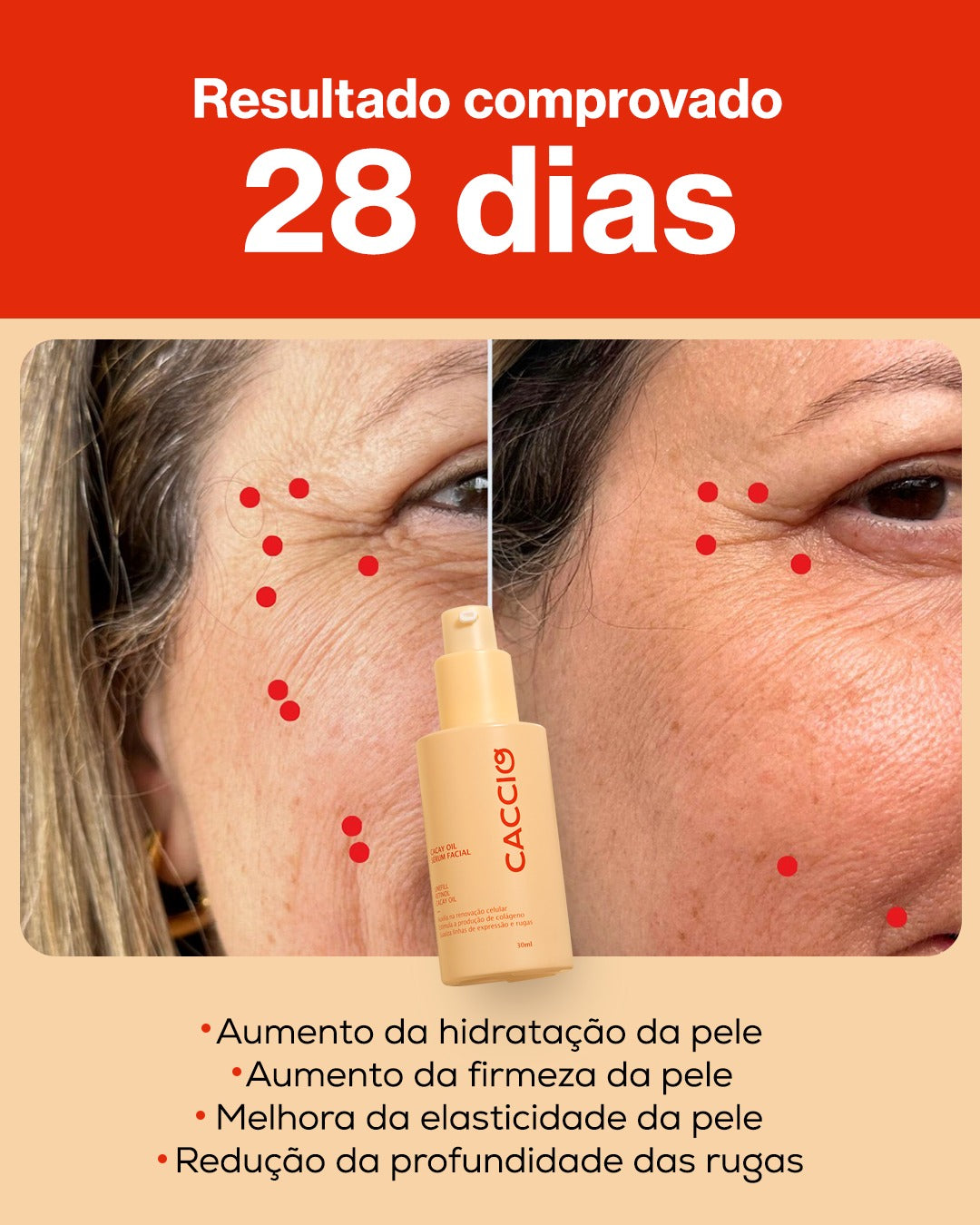 Kit Antissinais Completo